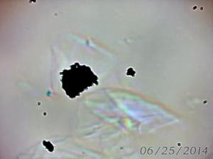 cheek cell taken through DIY microscope