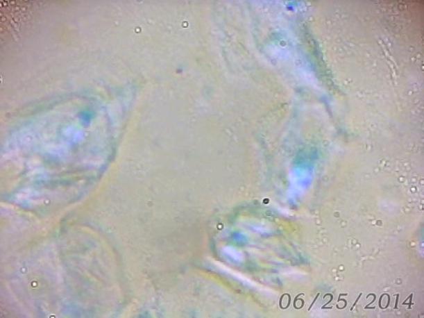 Cheek cell photo using DIY microscope, by Joe Corcoran and Paul Turner